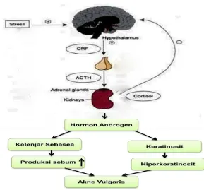 Gambar 1. Pengaruh stres terhadap terjadinya akne vulgaris (Rahmawati, 2012). 