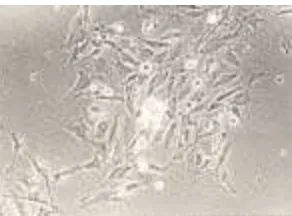 Figure 5. The confluent culture of the cultured cells from canine basal celltumor. a. The polygonal cells were surrounded by spindle cells,phase-contrast x225; b
