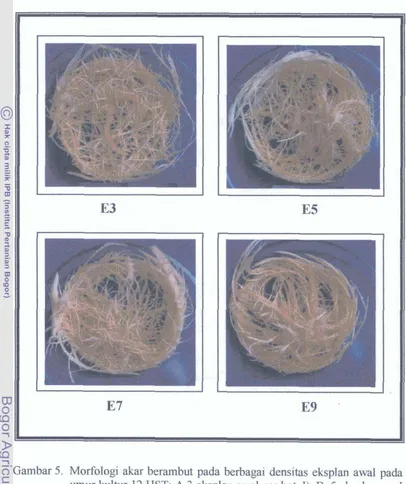 Gambar 5. Morfologi akar berambut pada berbagai densitas eksplan awal pada 