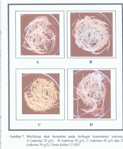 Gambar 7. Morfologi akar berambut pada berbagai konsentrasi sukrosa: 