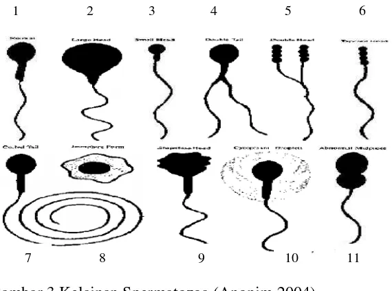 Gambar 3 Kelainan Spermatozoa (Anonim 2004)