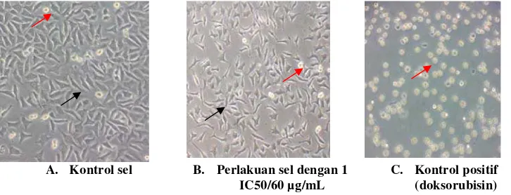 Gambar 2. Hasil percobaan kontrol sel, perlakuan dengan tilirosida dan doksorubisin. Keterangan : Panah hitam (       ) sel hidup dan panah merah (       ) sel mati 