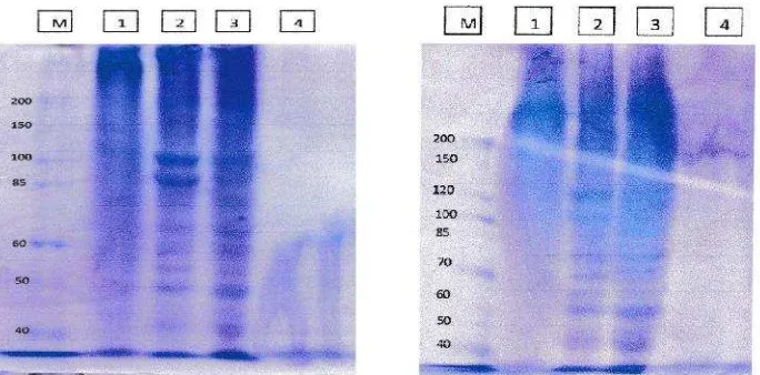 Gambar 1. Elektroforegram produk gelatin