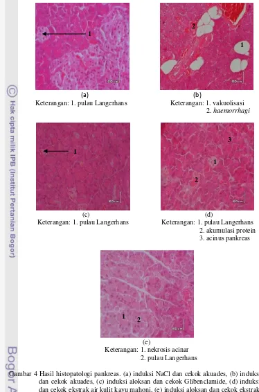 Gambar 4 Hasil histopatologi pankreas. (a) induksi NaCl dan cekok akuades, (b) induksi aloksan 