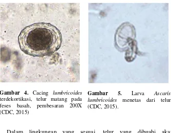 Gambar 4. Cacing lumbricoides