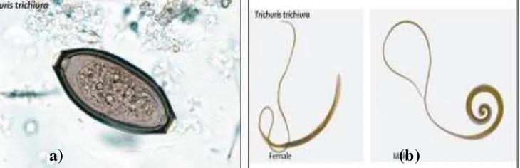 Gambar 4. (a) Telur Trichuris trichiura  (b) Cacing T. Trichiura dewasa jantan dan betina (Bethony et al., 2006) 