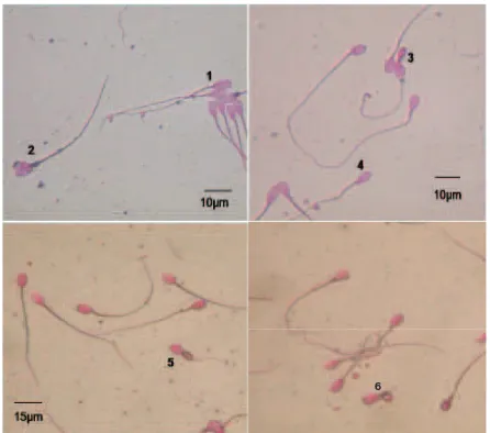 Gambar 1. Fotomikrograf spermatozoa anoa yang menunjuk-kan: spermatozoa normal (1), kepala ganda (2), simple bent (3), narrow at the base (4), double folded (5) dan coiled under the head (6)