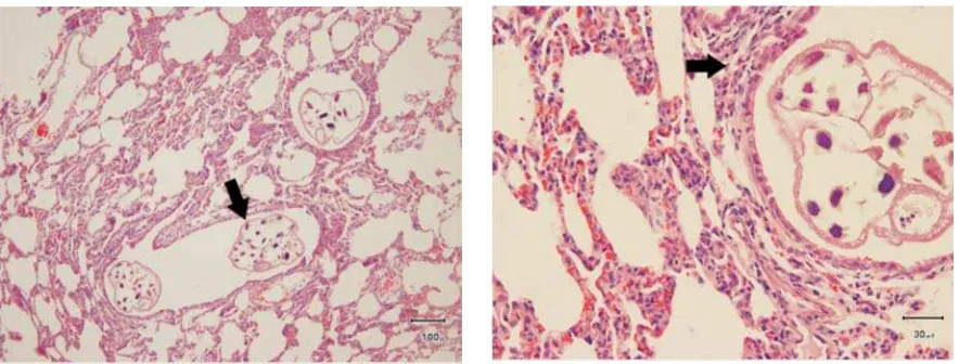 Gambar 2. Fotomikrograf penebalan septa alveolioleh Aelurostrongylus sp (tanda panah), bar =30 µm
