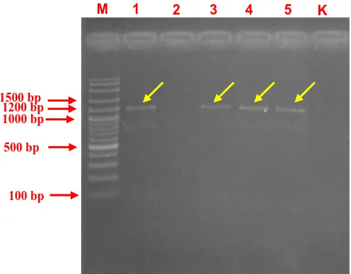Gambar 3.  Elektroforegram hasil amplifikasi DNA dari kandidat transforman 35S::KNAT1 V