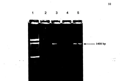 Gambar 2. Hasil uji amplifikasi PCR dengan menggunakan primer spesifik crylAc 