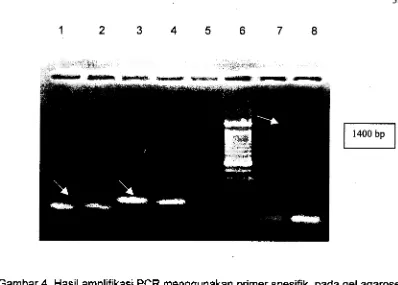 Gambar 4. Hasil amplifikasi PCR menggunakan primer spesifik pada gel agarose 