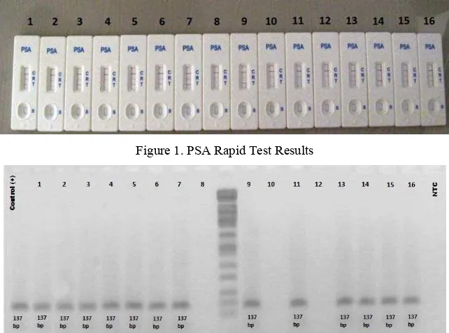 Figure 1. PSA Rapid Test Results 
