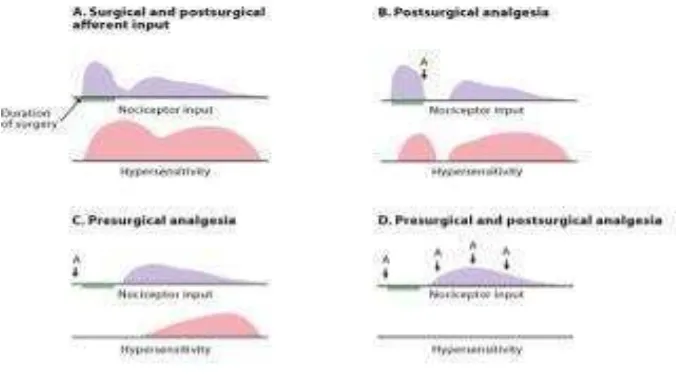Gambar 2.2 Perbandingan cara pemberian analgesia dengan penekanan pada pencegahan sensitisasi saraf selama perioperatif