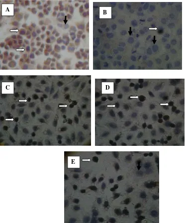 Figure 2  Endothelial cells with SOD-2  positive by immunohistochemical method 
