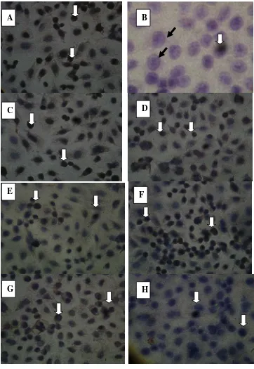 Figure 4  Endothelial cells with SOD-3 positive by immunohistochemical method 