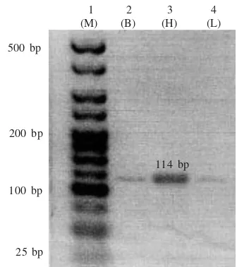 Figure 2. Partial cDNA fragment (114 bp) of C. mydas myoglobinfrom tukik brain (B), heart (H), liver (L) by using F2 andR1 primers; lane 1 = DNA marker Hyperladder V-Bioline(M).