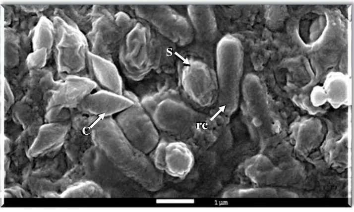 Gambar 1. Hasil scanning kristal protein Bt yang diamati menggunakans : spore, c : protein crystal, rc : rod cell ( Sahayaraj, 2014 )