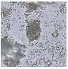Gambar 4. Telur Hookworm (CDC. 2013)