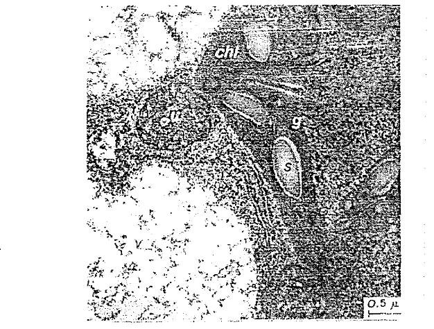 Gambar 2. Karakteristik sel Flavec!c:bctiran pati (s) yang rrlengindiknok-r: ,;lrtifn:~a 