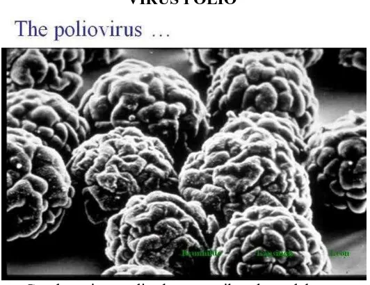 Gambar ilustrasi virus polio Virus polio adalah virus paling kecil dibandingkan dengan virus lainnya