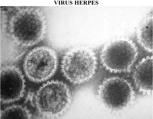 Gambar ilustrasi virus Herpes 