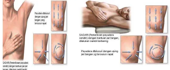 Gambar 3. Penampakan Payudara Secara Visual   