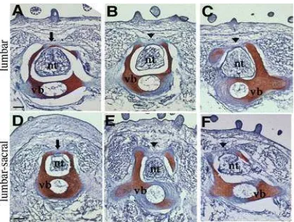 Gambar 2. Gambaran Mikroskopis Tabung Saraf Embrio (Waes et al, 2005) (2E) Tabung saraf yang menutup sempurna; (2F) tabung saraf yang terbuka 