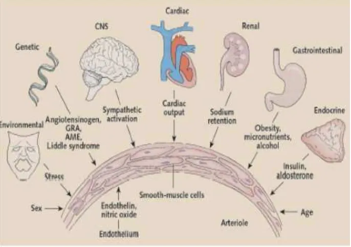 Gambar 1. Faktor-Faktor Yang Menyebabkan Terjadinya Hipertensi (Departemen Kesehatan, 2006) 