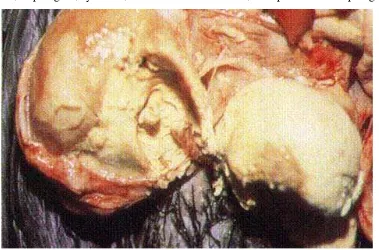 Gambar 1. Salphingitis kronis pada ayam tua akibat E. Coli (Shane,                               1988) 