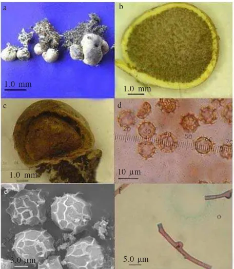 Figure 3. Cultural characters of Scleroderma sp. in Modified Melin-Norkrans (MMN) agar media