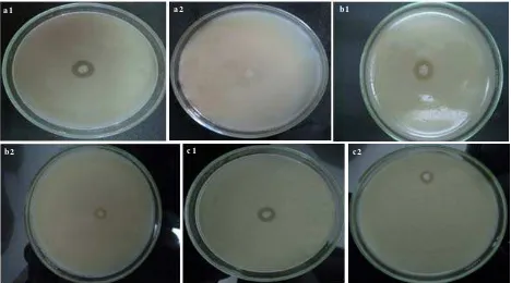 Figure 1. Comparison between (a1) control (EPEK K.1.1) and (a2) application of SAB S-12 against EPEK K.1.1, (b1) control (S.aureus) and (b2) application of SAB S-21 against S