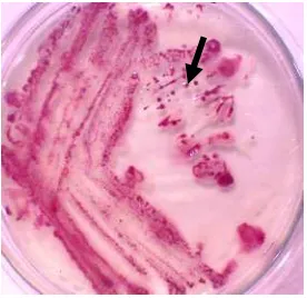 Gambar 2  Biakan murni R. solanacearum pada medium TZC;  koloni tunggal yang virulen (tanda panah) bagian tengah berwarna merah muda dikelilingi lendir berwarna putih