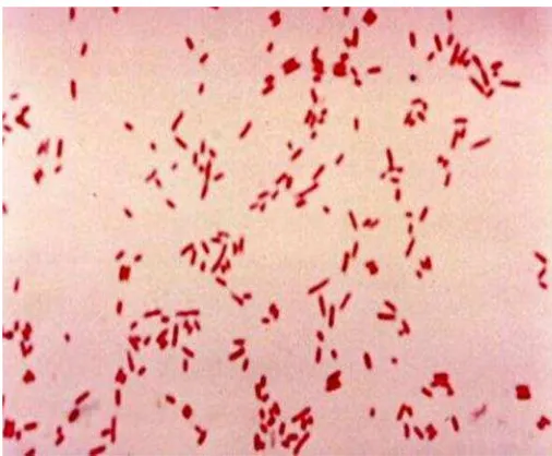 Gambar 3.Kuman Escherichia coli dapat diwarnai dengan pewarnaan Gram, hasilnyaGram (-)