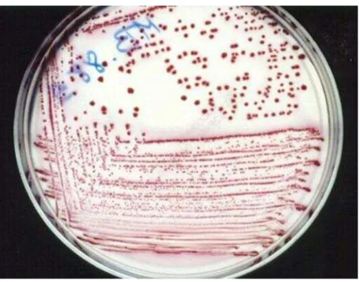 Gambar 4.Koloni Escherichia coli yang tumbuh di dalam media differensial MacConcey agar yang mengandung substrat dan bahan-bahan media yanghanya dapat ditumbuhi oleh kuman enterik Gram-negatif (Maddapa et al,.2016).