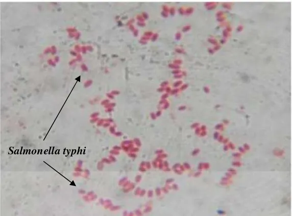Gambar 1. Salmonella typhi perbesaran 1000x (Pratiwi, 2015)
