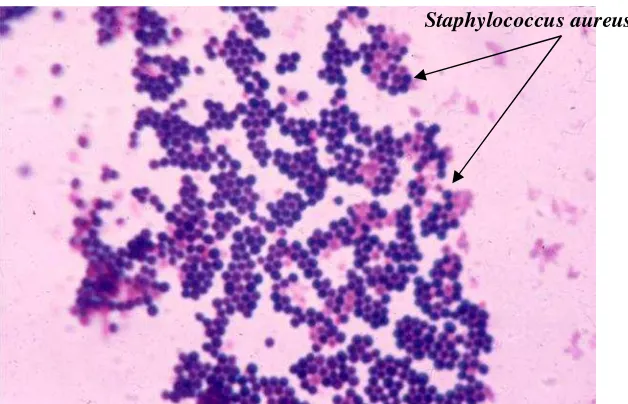 Gambar 2. Staphylococcus aureus perbesaran 1000x (Todar, 2009)