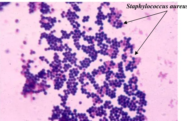 Gambar 2. Staphylococcus aureus perbesaran 1000x (Todar, 2009)