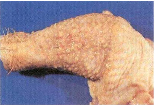 Gambar 3. Tumor pada kulit kaki ayam (Anonimus, 2007)  