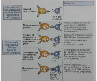 Gambar 2.1. Tipe-tipe antigen tumor yang dapat dikenali oleh sel-sel T 
