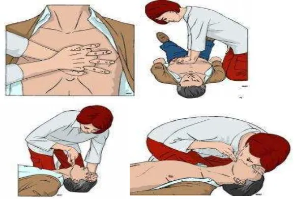 Gambar 3. Proses melakukan RJP dengan teknik yang tepat (Berg et al., 2010) 