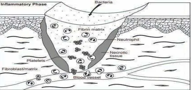 Gambar 1. Fase inflamasi penyembuhan luka. (Sumber: Gurtner GC, Thorme CH. Wound Healing: Normal and Abnormal