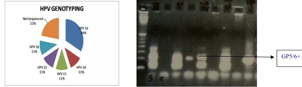Figure : 3. Sequence result of the PCR product of HPV Typing.