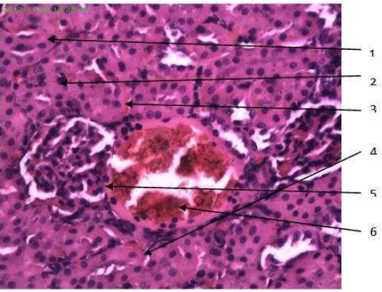 Gambar 6.  Histopatologi ginjal tikus kelompok kontrol patologis; Pewarnaan H-E; Ket: 1