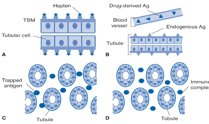 Gambar 8. Mekanisme terjadinya acute tubular necrosis akibat penggunaan obat rifampisin (Lerma, 2008)