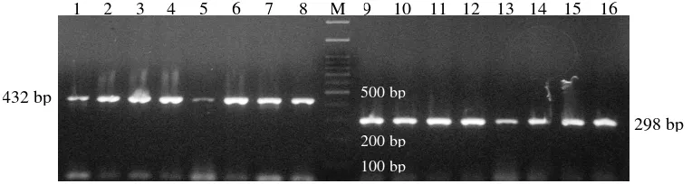 Gambar 3. Visualisasi hasil amplifikasi ruas gen GH dan GHR pada gelagarosa 1,5%. 1-8: ruas gen GH, M: marker 100 bp, dan 9-16:ruas gen GHR.