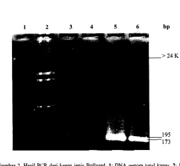 Gambar 2. Hasil PCR dari kapas jenis Bollgard, 1: DNA genom total kapas, 2: Marker 