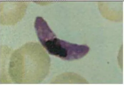 Gambar 3. Bentuk skizon Plasmodium falciparum dengan perbesaran 100x (Sumber: Prianto dkk, 2010) 