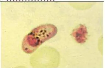 Gambar 5. Bentuk mikrogametosit Plasmodium falciparum dengan perbesaran 100x (Sumber: Prianto dkk, 2010) 