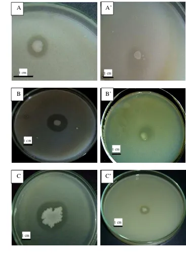 Gambar 2 Uji inhibitor protease bakteri patogen dengan bakteri yang berasosiasi dengan spons Jaspis sp