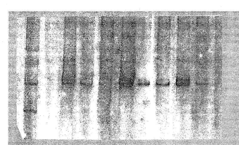 Gambar 1. Kolom pertama adalah DNA ladder 100 bp, kolom 2 kosong, kolom 3-8 adalah produk PCR Elektrogram produk PCR menggunakan pasangan primer GHI dan GH2